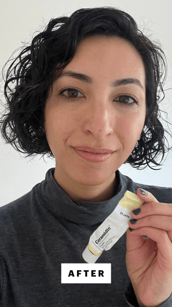 Pai after applying the Dr. Jart Ceramidin Skin Barrier Moisturizing Cream