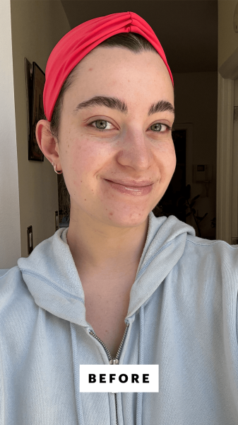 A selfie of Allure senior commerce editor Sarah Felbin before using the Paula's Choice Skin Perfecting 2 BHA Liquid...